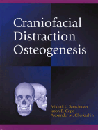 Craniofacial Distraction Osteogenesis