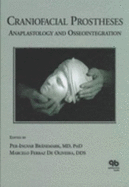 Craniofacial Prostheses: Anaplastology and Osseo Integration