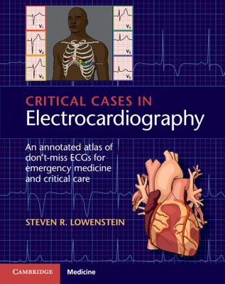 Critical Cases in Electrocardiography - Lowenstein, Steven R