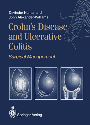 Crohn's Disease and Ulcerative Colitis: Surgical Management - Kumar, Devinder, and Alexander-Williams, John