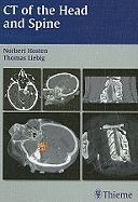 CT of the Head and Spine