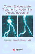 Current Endovascular Treatment of Abdominal Aortic Aneurysms