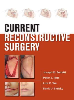 Current Reconstructive Surgery - Serletti, Joseph M, and Taub, Peter J, and Wu, Liza