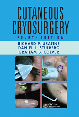 Cutaneous Cryosurgery - Colver, Graham B