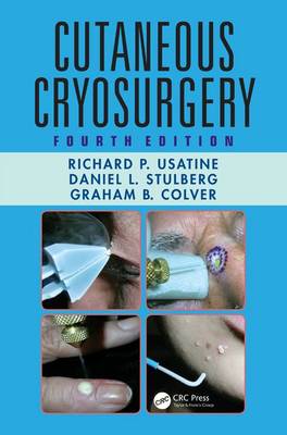 Cutaneous Cryosurgery - Colver, Graham B