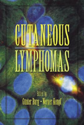 Cutaneous Lymphomas - Burg, Gunter (Editor), and Kempf, Werner (Editor)
