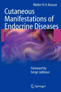 Cutaneous Manifestations of Endocrine Diseases