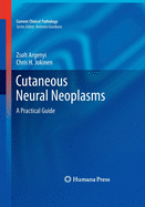 Cutaneous Neural Neoplasms: A Practical Guide