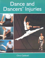 Dance and Dancers' Injuries
