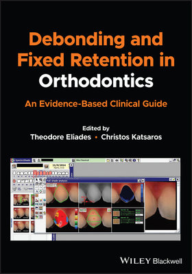 Debonding and Fixed Retention in Orthodontics: An Evidence-Based Clinical Guide - Eliades, Theodore (Editor), and Katsaros, Christos (Editor)