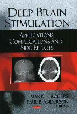 Deep Brain Stimulation - Rogers, Mark H