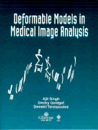 Deformable Models in Medical Image Analysis