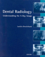 Dental Radiology: Understanding the X-Ray Image