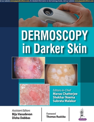 Dermoscopy in Darker Skin - Chatterjee, Manas, and Neema, Shekhar, and Malakar, Subrata