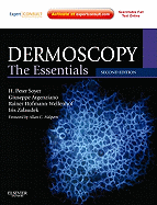 Dermoscopy: The Essentials: Expert Consult - Online and Print