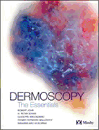 Dermoscopy: the Essentials
