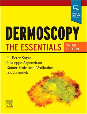 Dermoscopy: The Essentials - Soyer, H. Peter, MD, and Argenziano, Giuseppe, MD, and Hofmann-Wellenhof, Rainer, MD