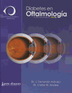 Diabetes En Oftalmologia