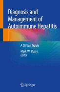 Diagnosis and Management of Autoimmune Hepatitis: A Clinical Guide