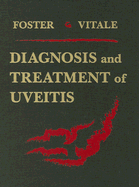 Diagnosis & Treatment of Uveitis