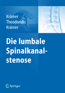 Die Lumbale Spinalkanalstenose