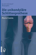 Die Unikondyl Re Schlittenprothese: Pro & Contra