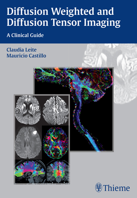 Diffusion Weighted and Diffusion Tensor Imaging: A Clinical Guide - Leite, Claudia (Editor), and Castillo, Mauricio (Editor)