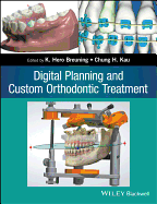 Digital Planning and Custom Orthodontic Treatment