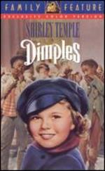 Dimples