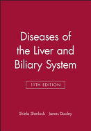 Diseases of the Liver and Biliary System