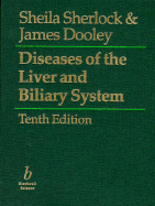 Diseases of the Liver and Biliary System