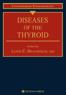 Diseases of the Thyroid