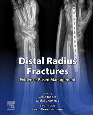 Distal Radius Fractures: Evidence-Based Management - Buijze, Geert Alexander (Editor), and Jupiter, Jesse, MD (Editor), and Chammas, Michel, MD, PhD (Editor)