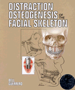 Distraction Osteogenesis of the Facial Skeleton