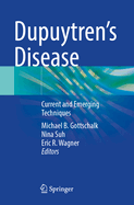 Dupuytren's Disease: Current and Emerging Techniques