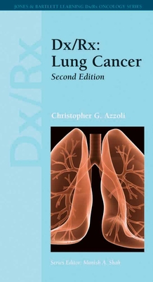 DX/Rx: Lung Cancer: Lung Cancer - Azzoli, Christopher G