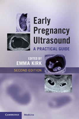Early Pregnancy Ultrasound: A Practical Guide - Kirk, Emma (Editor)