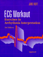 ECG Workout: Exercises in Arrhythmia Interpretation