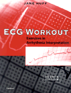 ECG Workout: Exercises in Arrhythmia Interpretation