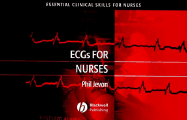 ECGs for Nurses