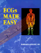 ECGs Made Easy