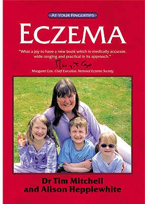 Eczema AYF - Mitchell, Tim, and Hepplewhite, Alison
