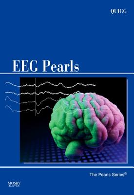 EEG - Quigg, Mark