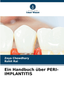Ein Handbuch ?ber PERI-IMPLANTITIS