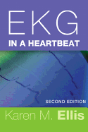 EKG in a Heartbeat