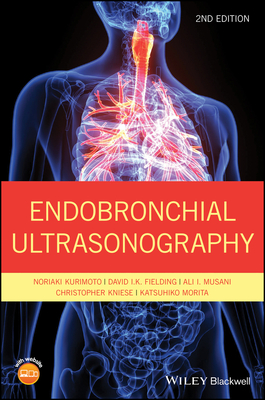 Endobronchial Ultrasonography - Kurimoto, Noriaki, and Fielding, David I. K., and Musani, Ali I.