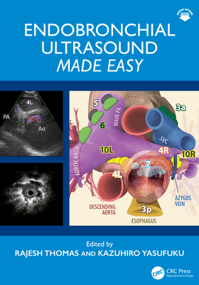 Endobronchial Ultrasound Made Easy - Thomas, Rajesh (Editor), and Yasufuku, Kazuhiro (Editor)