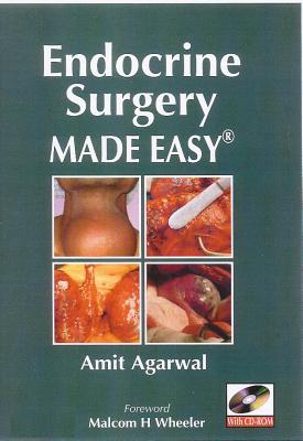 Endocrine Surgery Made Easy - Agarwal, Amit