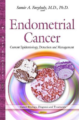 Endometrial Cancer: Current Epidemiology, Detection & Management - Farghaly, Samir A, M.D., PhD (Editor)