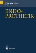 Endoprothetik